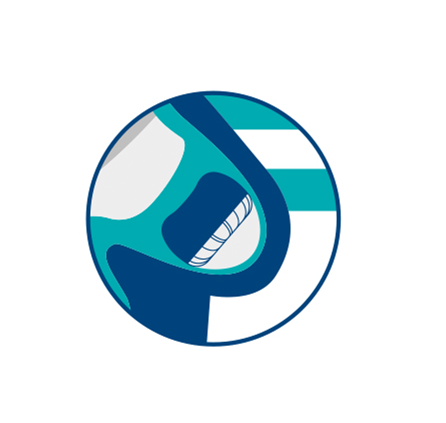 Diagram of WATCHMAN Implant in heart.