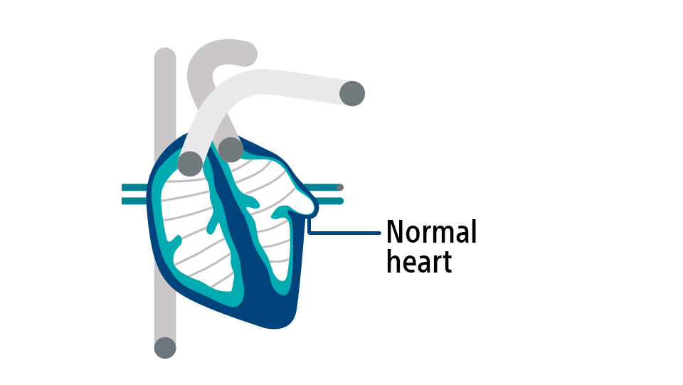 Diagramm eines gesunden Herzens.