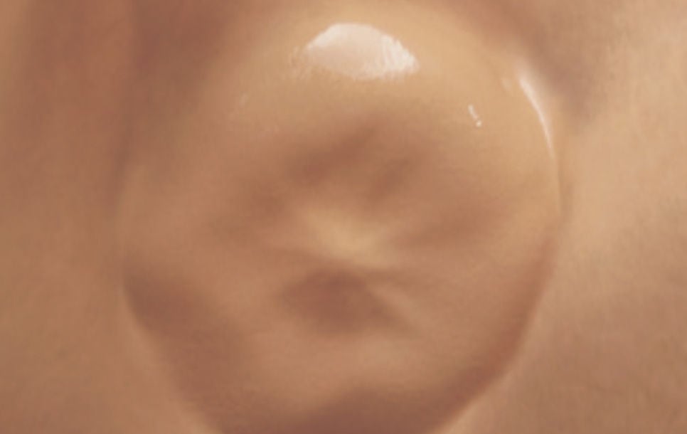 Rendering of WATCHMAN Implant fully endothelialized in heart.