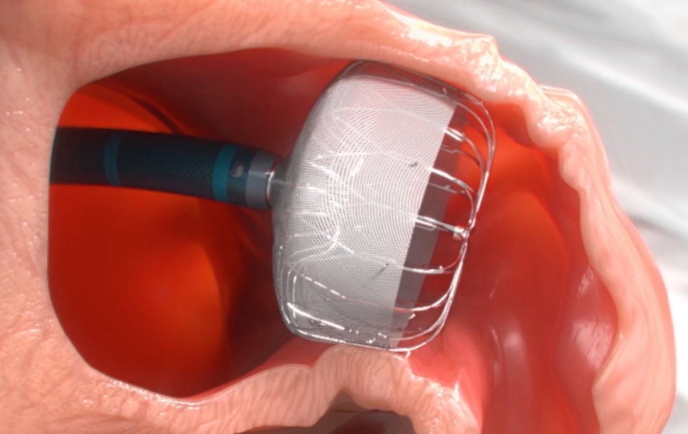 Rendering of WATCHMAN Implant being released in heart.
