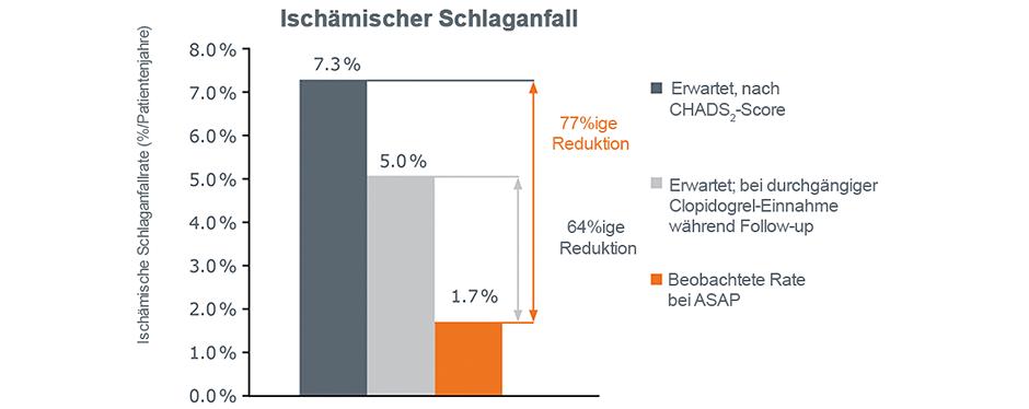 Ischämischer Schlaganfall Ischämischer Schlaganfall