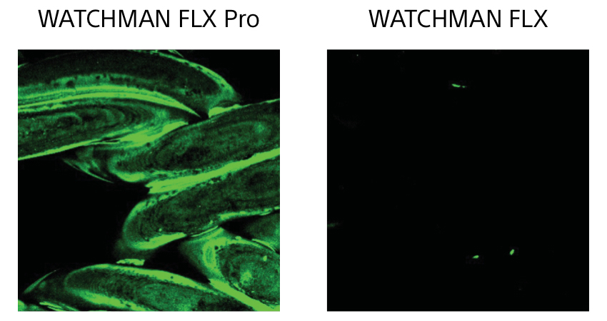 Albumin comparision images between WATCHMAN FLX Pro and WATCHMAN FLX.