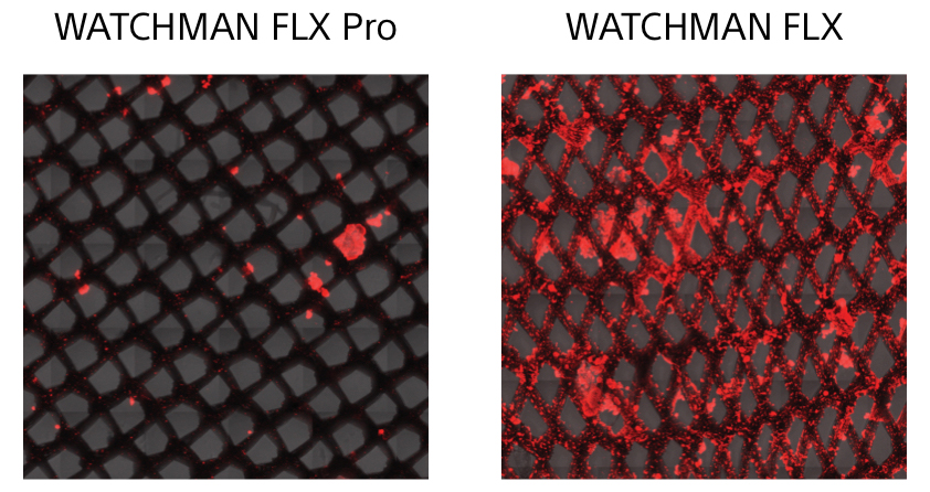 Platelet binding comparision images between WATCHMAN FLX Pro and WATCHMAN FLX.
