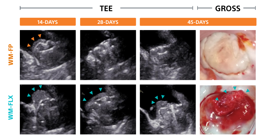 TEE and gross comparision images between WATCHMAN FLX Pro and WATCHMAN FLX.