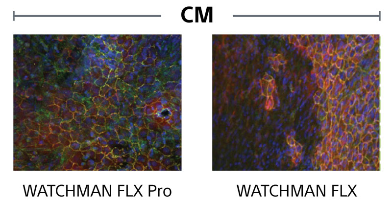 CM comparision imagesbetween WATCHMAN FLX Pro and WATCHMAN FLX.