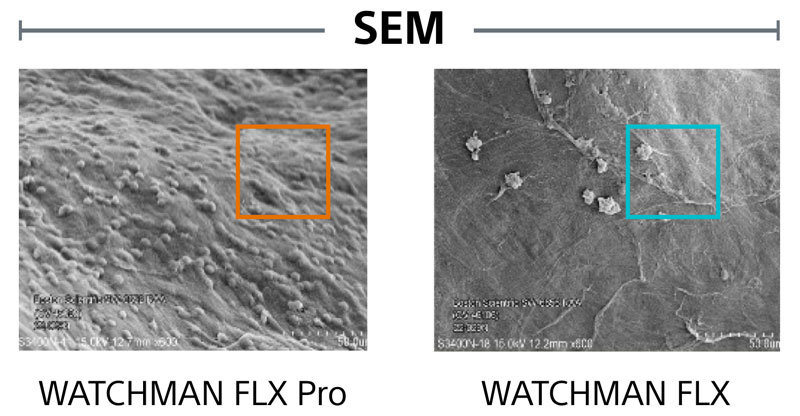 SEM comparision imagesbetween WATCHMAN FLX Pro and WATCHMAN FLX.
