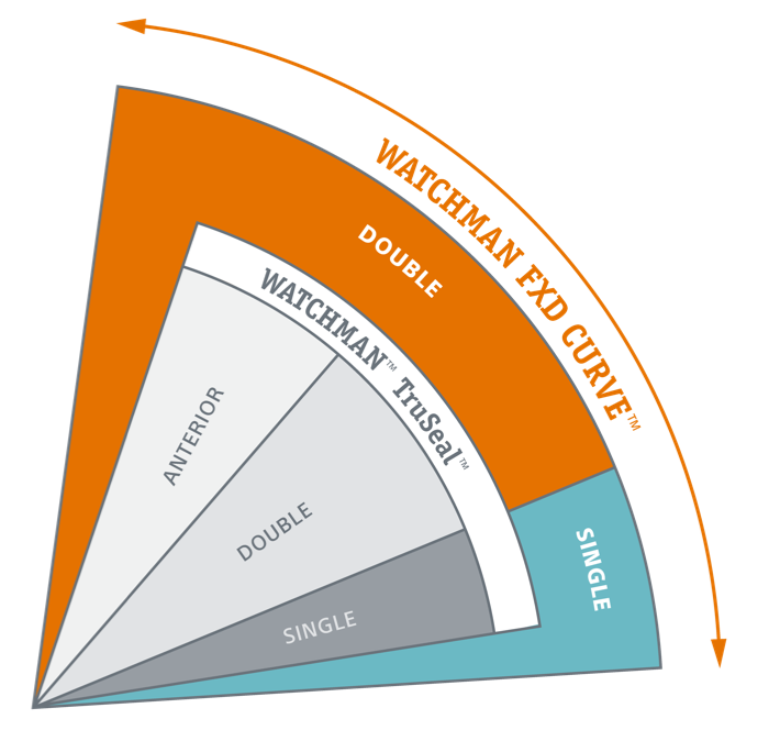 WATCHMAN FXD Curve Graph