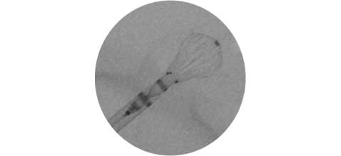 Magnification of device.