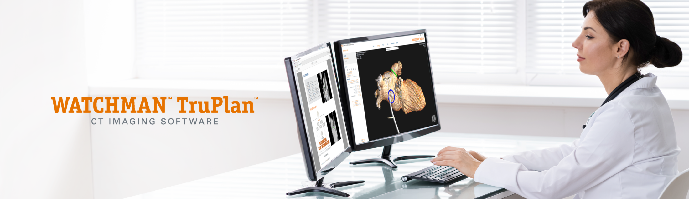 WATCHMAN TruPlan CT Imaging Software