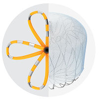 A half WATCHMAN and half FARAPULSE device on a grey background