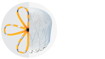 A combined cross-section of both the FARAPULSE and WATCHMAN devices.